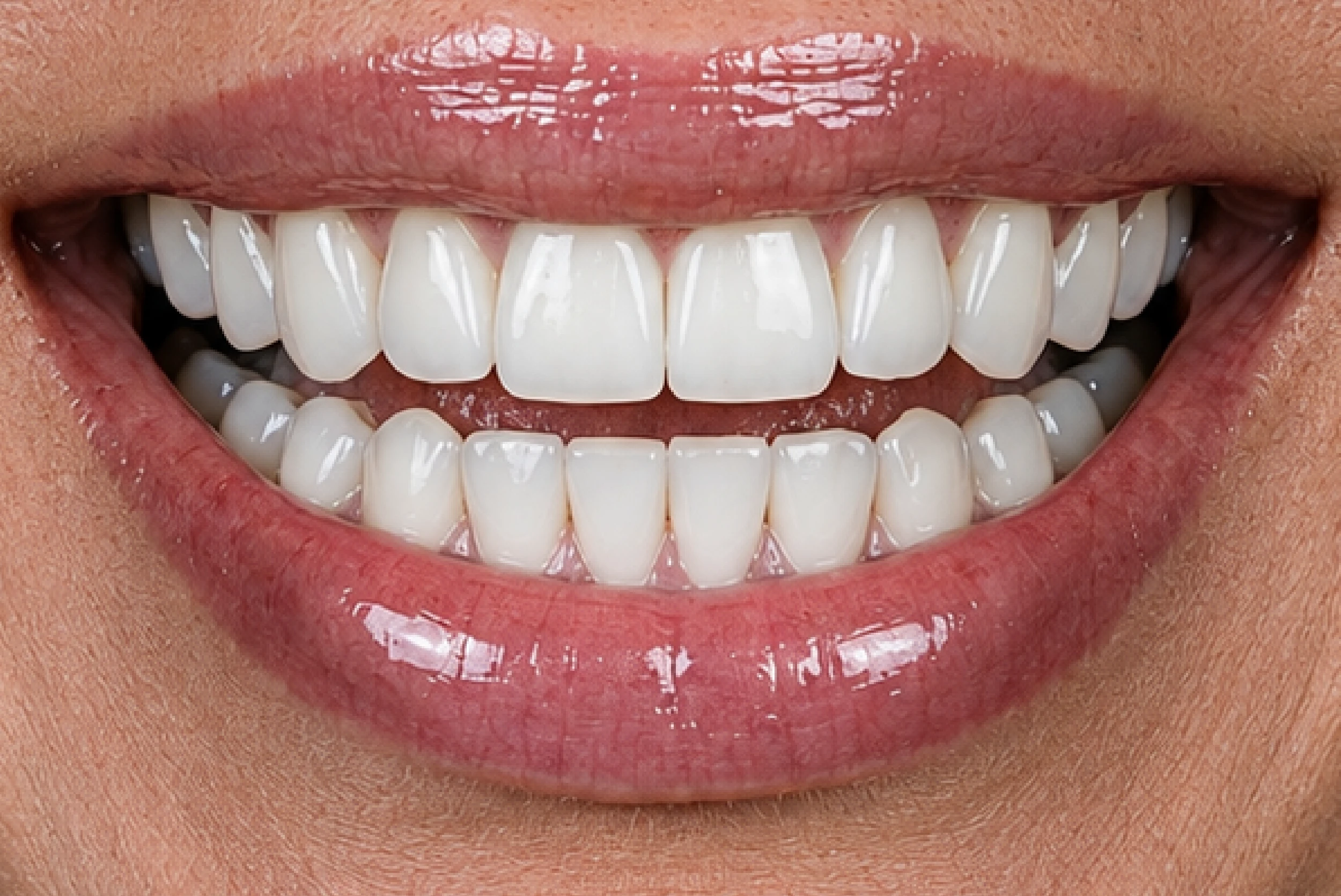 After bite correction treatment